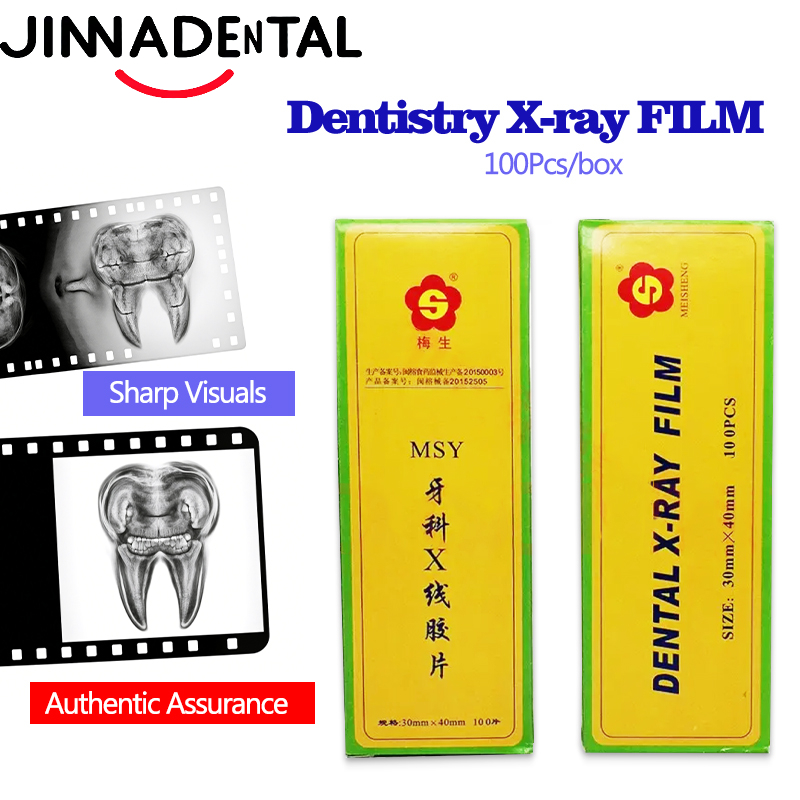 ฟิล์มเอ็กซ์เรย์ทันตกรรมขนาด 30 - Medical Lab Images บทวิจารณ์และราคา